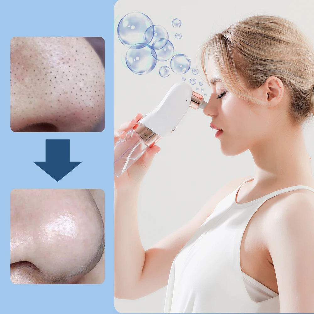 Removedor de cravos com hidratação de bolhas – Limpeza profunda e rejuvenescimento da pele